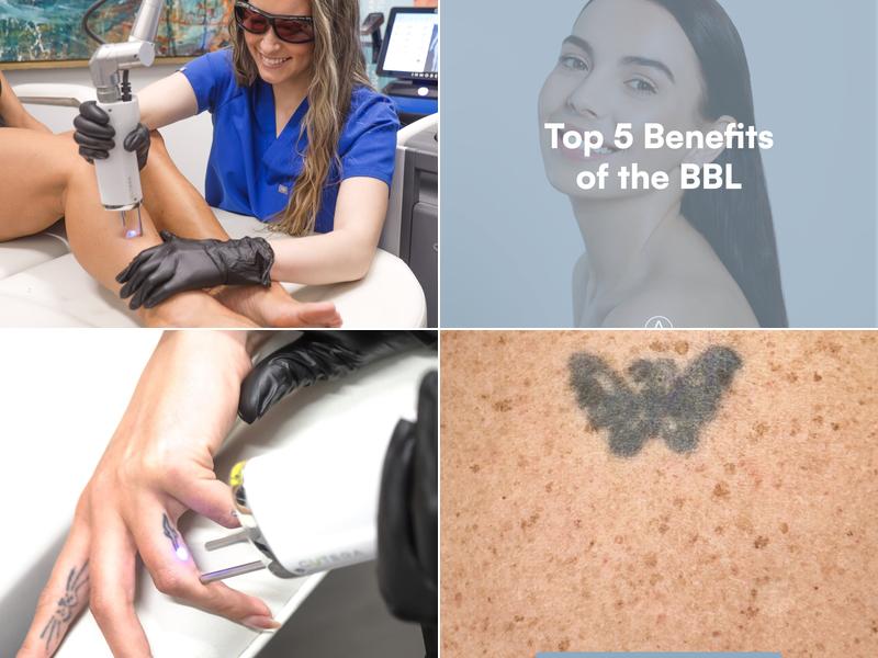 Austin Laser Solutions - Tattoo Removal INC