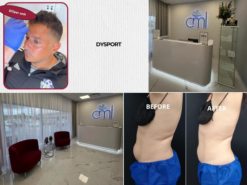 Canada Medlaser Vaughan