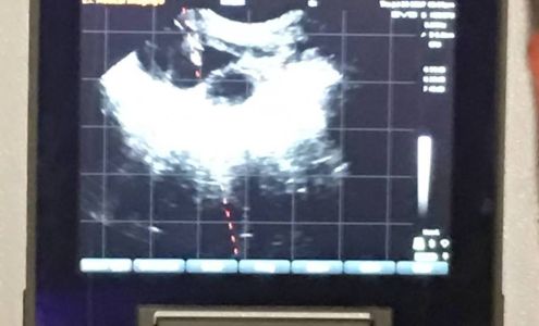 Stanton Farms Coeymans Hollow