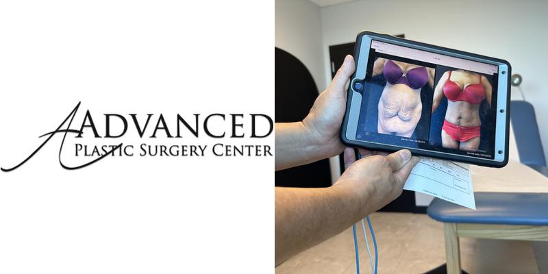 Advanced Plastic Surgery Center