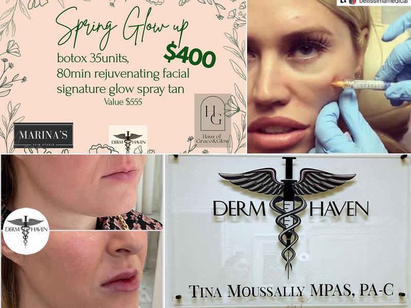 Derm Haven Tina Moussally MPAS, PA-C