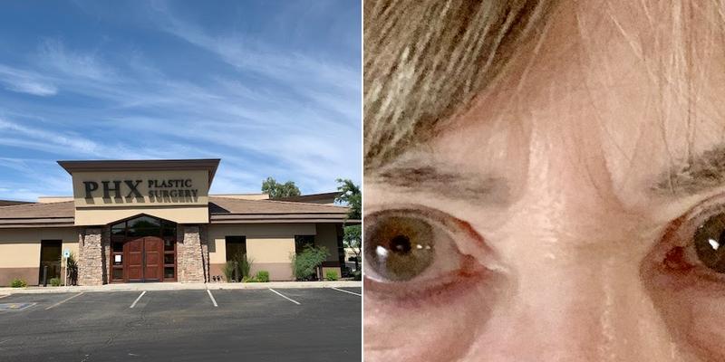 PHX Plastic Surgery: Dr. Jason Johnson