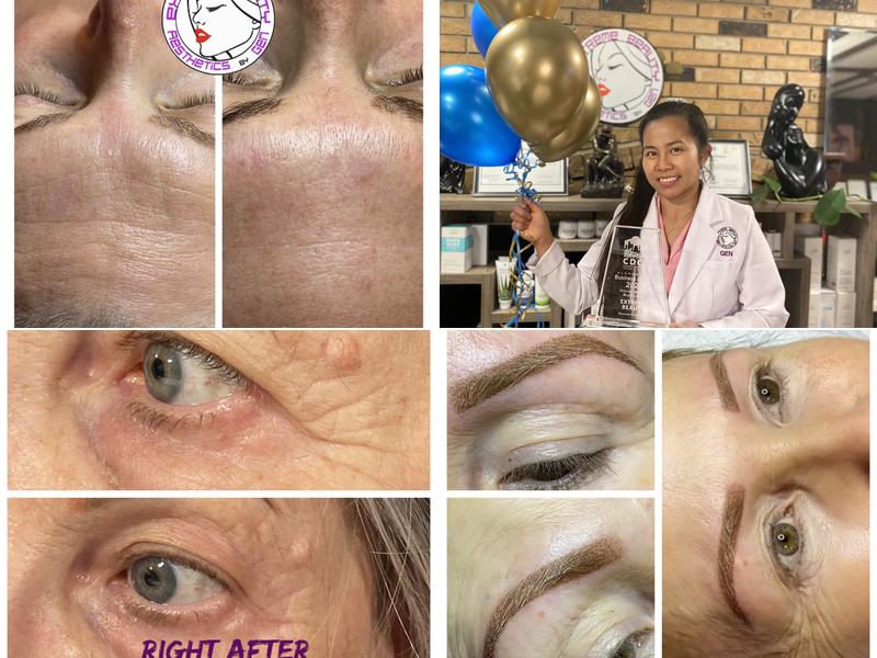 eXtreme Beauty Aesthetics By Gen