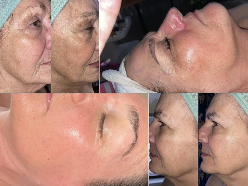 Bree Elizabeth Aesthetics