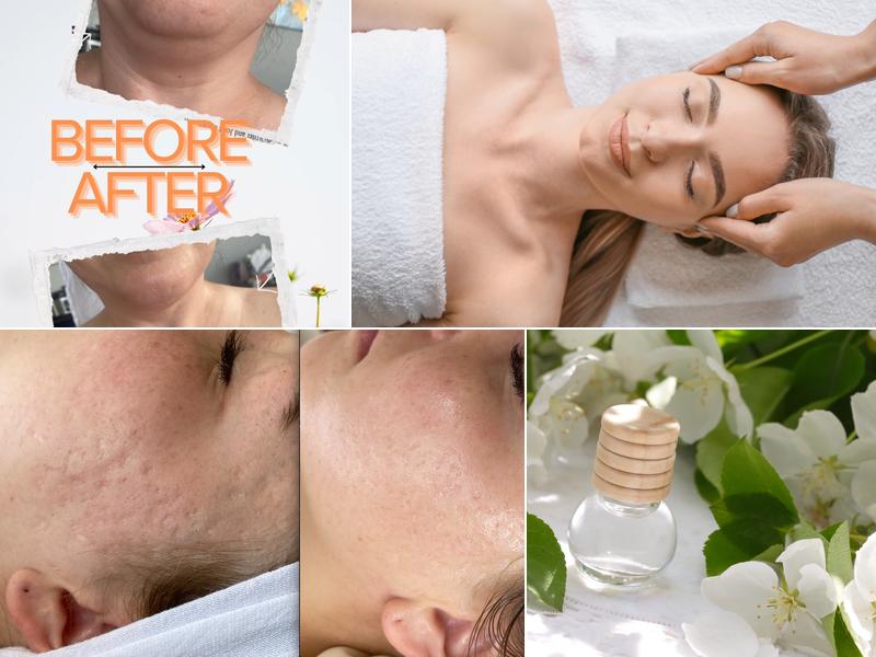 DERMA SOULE Facial, Body Treatment Spa