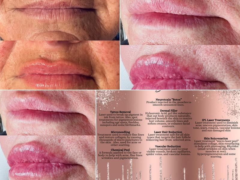 Bella Aesthetics by Amber