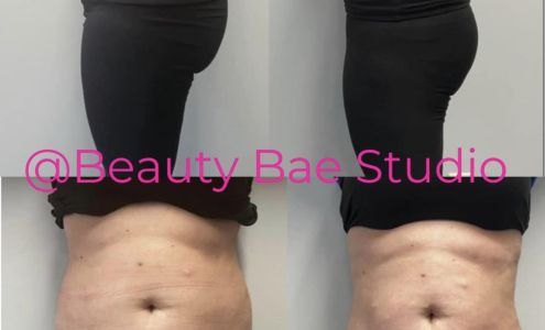 Beauty Bae Studio Body Spa 6320 Monona Dr suite 215, Monona Wisconsin 53716