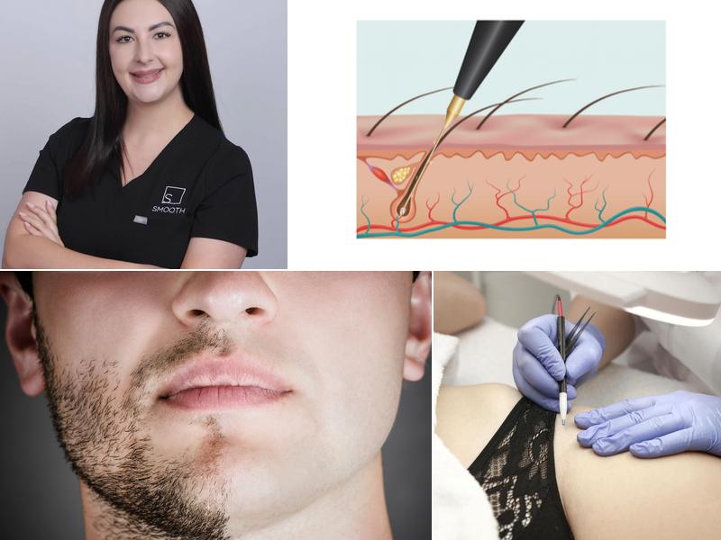 SMOOTH - Electrolysis by Shelley