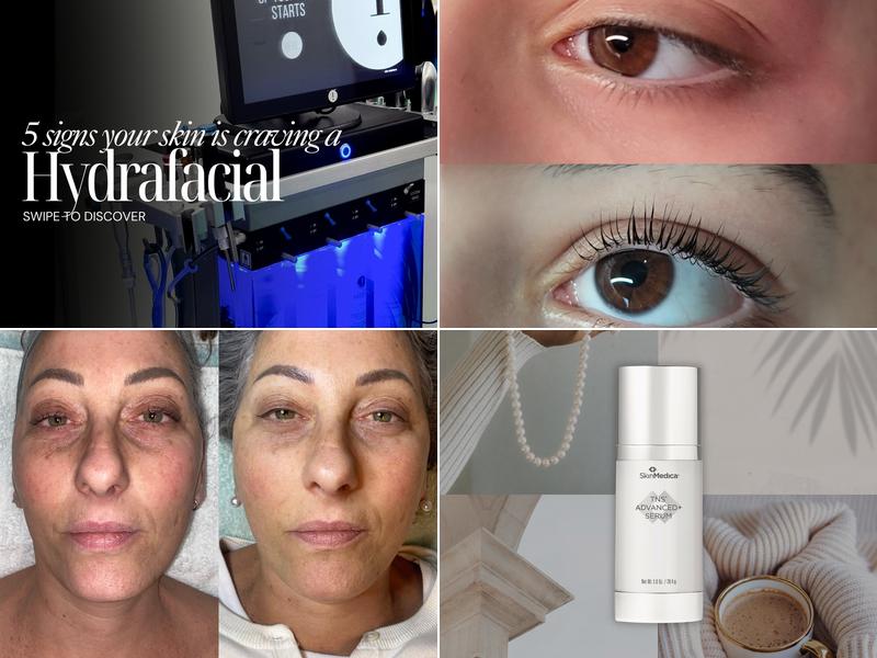 Glow Aesthetics & Spa