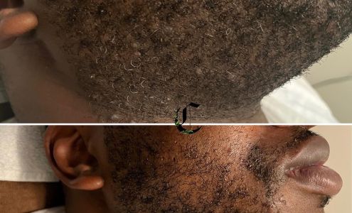 Curio Aesthetics 5384 N University Dr Suite #6, Lauderhill Florida 33351