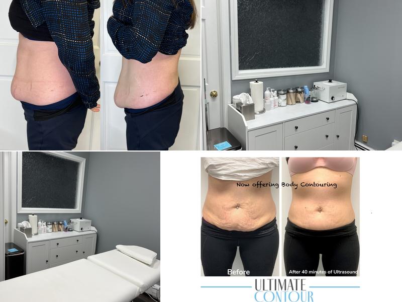 Smooth Skin Studios, LLC