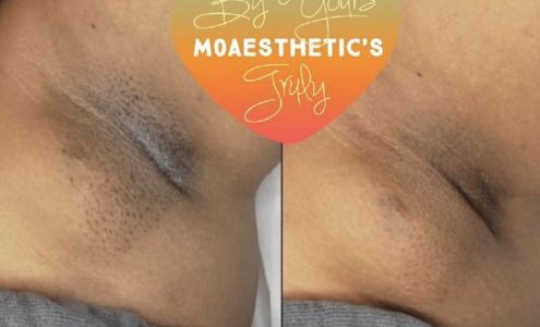 M0AESTHETICS 99 E Main St SUITE 21, Franklin Tennessee 37064