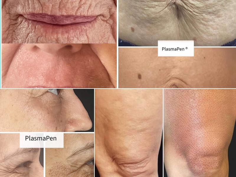 Cherry Blossom MedSpa