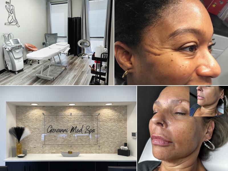 Giovanni Med Spa