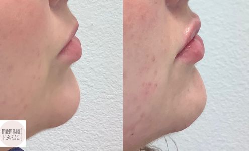 Fresh Face Aesthetics