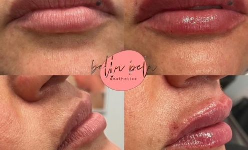 Bella Bela Aesthetics Millis