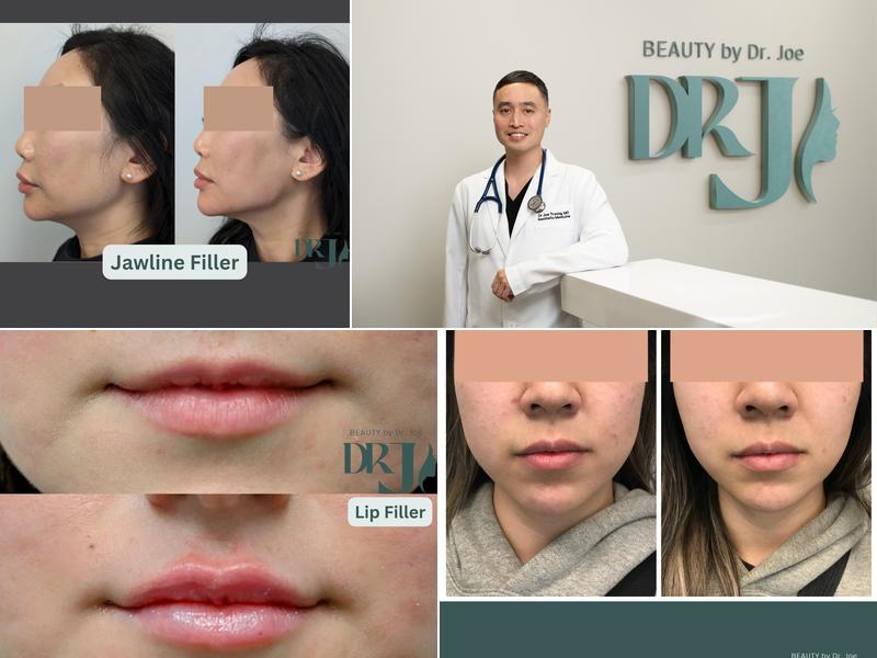 Beauty By Dr Joe - Botox and Fillers