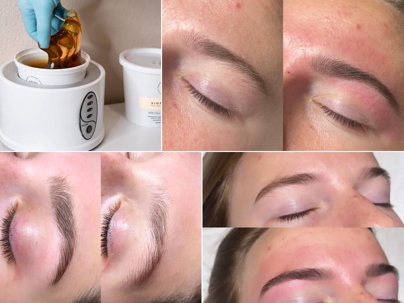 Sugar and Skin Aesthetics