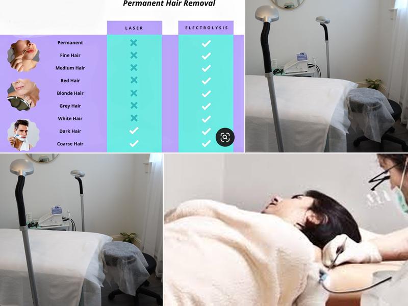 Lashes and Electrolysis by Anat