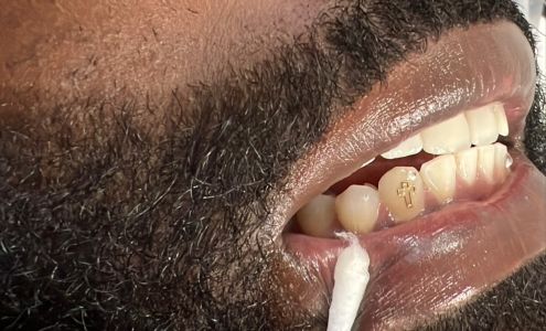 Glam Smiles St. Louis