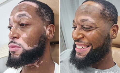 Natural Effects Medical Tattooing