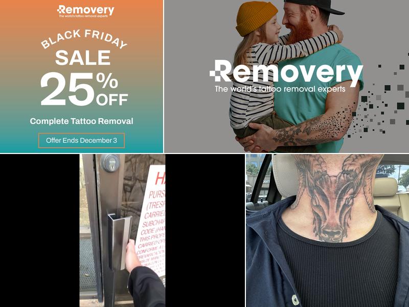 Removery Tattoo Removal & Fading