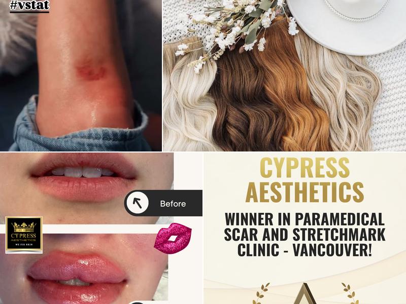 Cypress Aesthetics Inc.