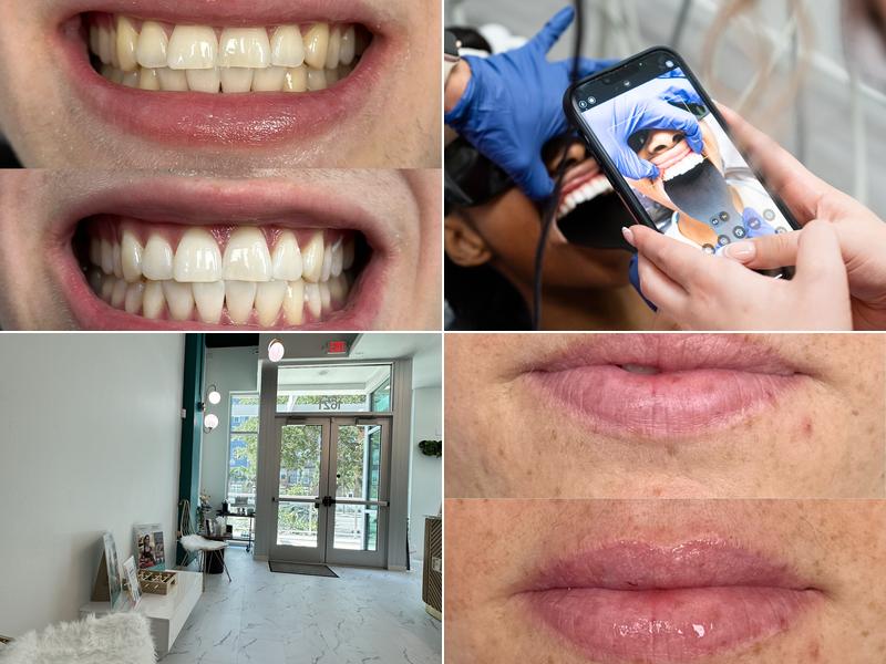 Flash Dentspa - St. Petersburg