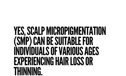 International Hairlines