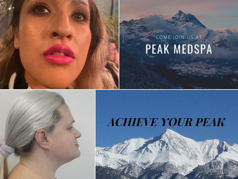 Peak Medspa