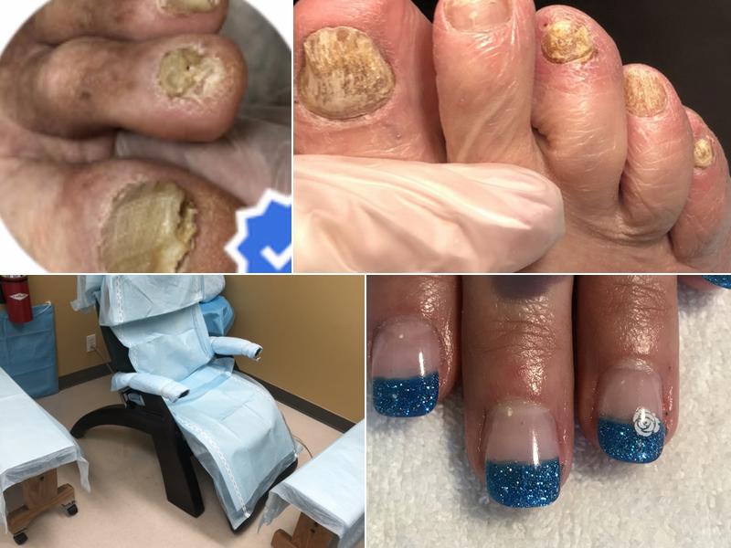 Euro Nails Advanced Medical pedicures