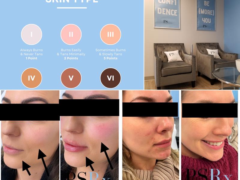 PSRx BODY & SKIN MED SPA ORLAND PARK