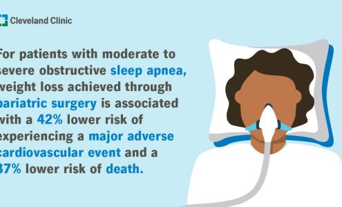 Akron General Need-A-Physician