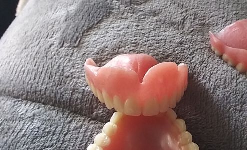 Affordable Dentures & Implants