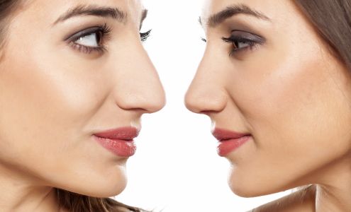 East Bay Plastic & Reconstructive Surgery