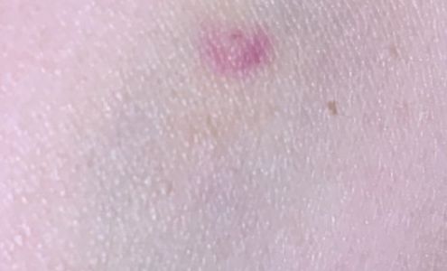 Kaiser Permanente: Clark Mark P MD