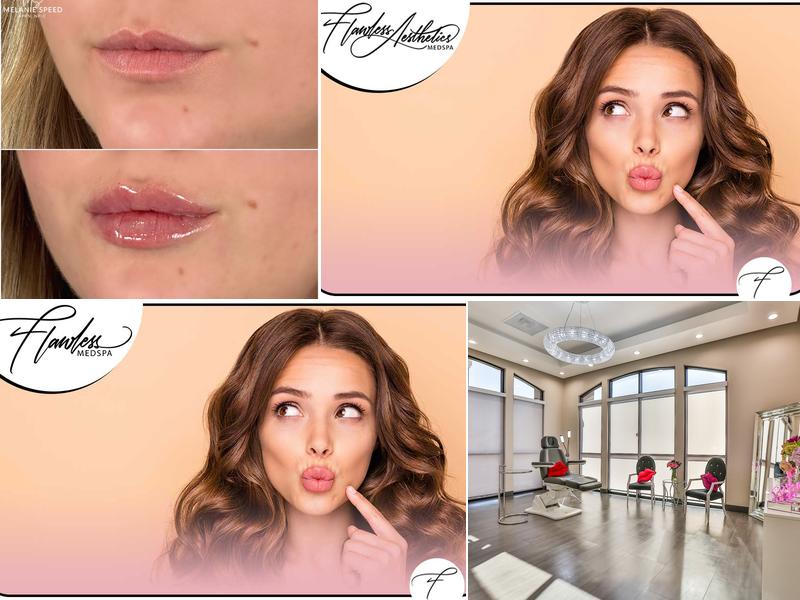 Flawless Medspa Las Vegas