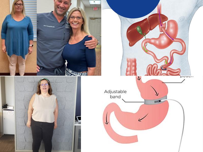 Advanced Bariatrics