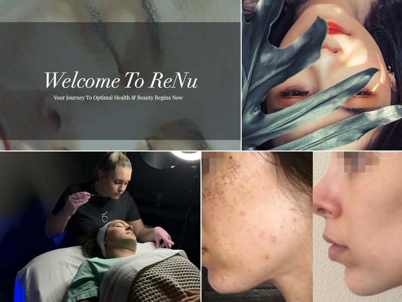 Renu Aesthetics and Wellness