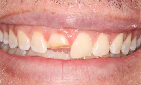 Wightman Family Dental 2212 Paris Rd, Chalmette Louisiana 70043