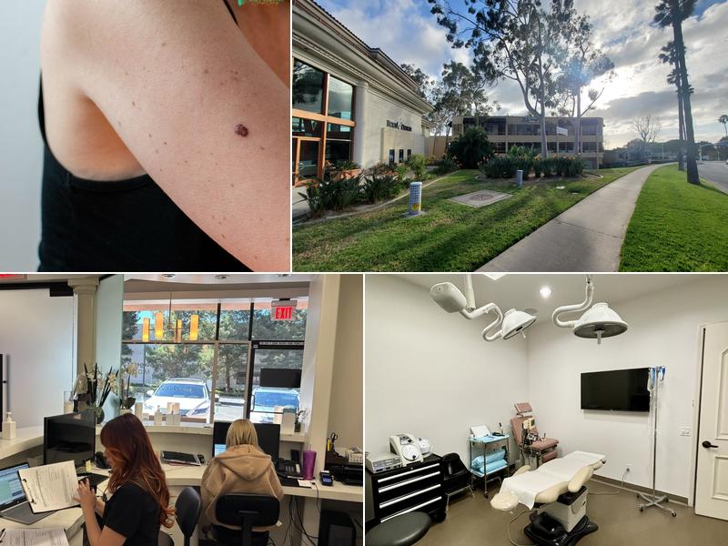 Mole Removal Orange County