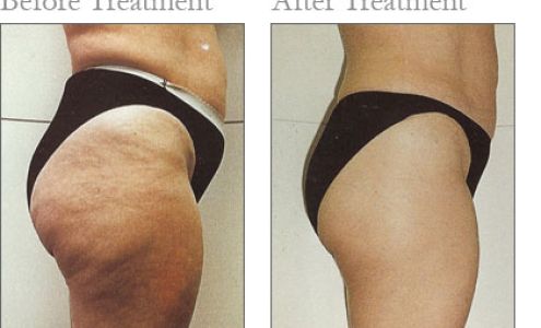 Perpetual Motion Body Improvement Center