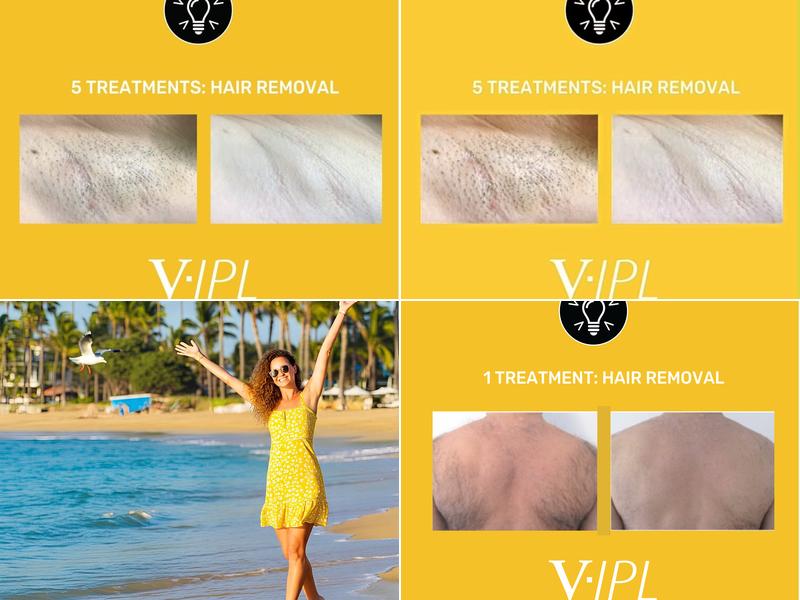 Everclear Electrolysis