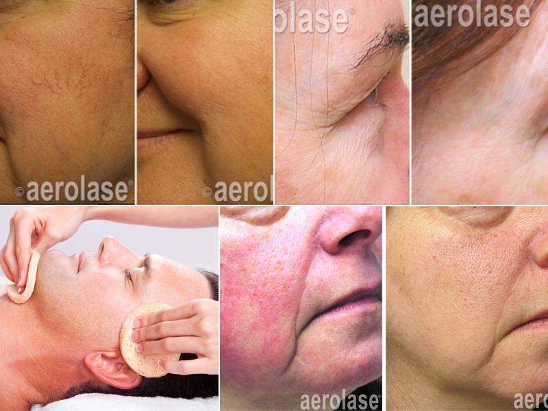 Ocean Laser Aesthetics and Tattoos