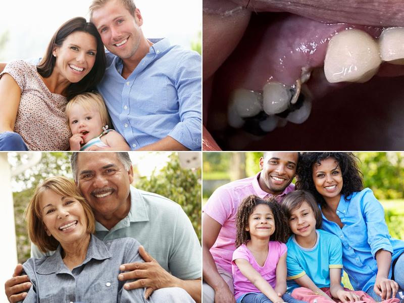 Advanced Dental Care