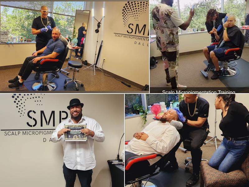 Scalp Micropigmentation Dallas