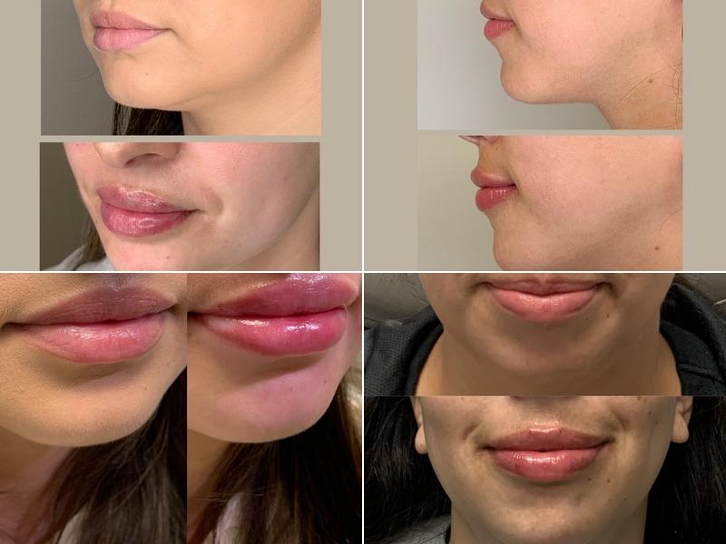 Illuminate Plastic Surgery - San Jose