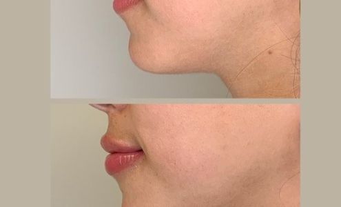 Illuminate Plastic Surgery - San Jose