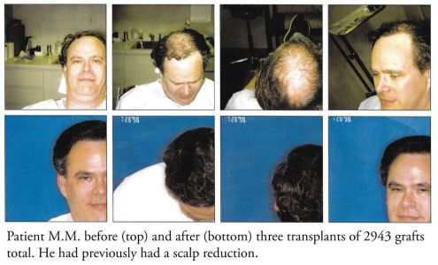 Pacific Hair Institute