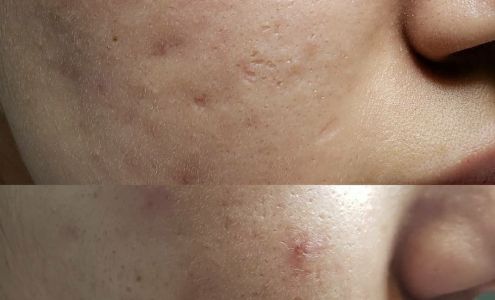 Cosmetic Esthetics/ Sheri Hurt